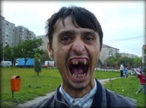 ugly people