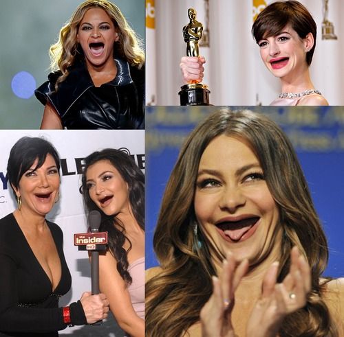 celebrities without teeth