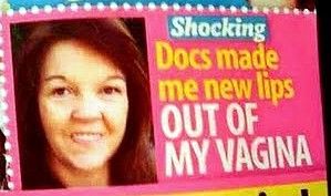 Shocking Docs made me new lips OUT OF MY VAGINA