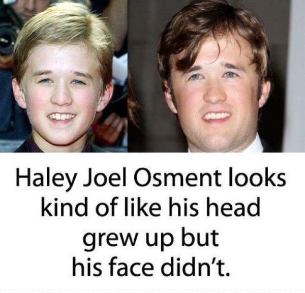Haley Joel Osment looks kind of like his head grew up, but his face didn't