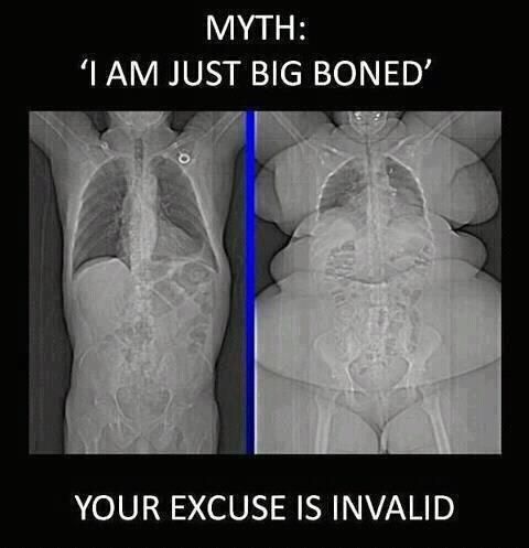 MYTH: 'I AM JUST BIG BONED' YOUR EXCUSE IS INVALID