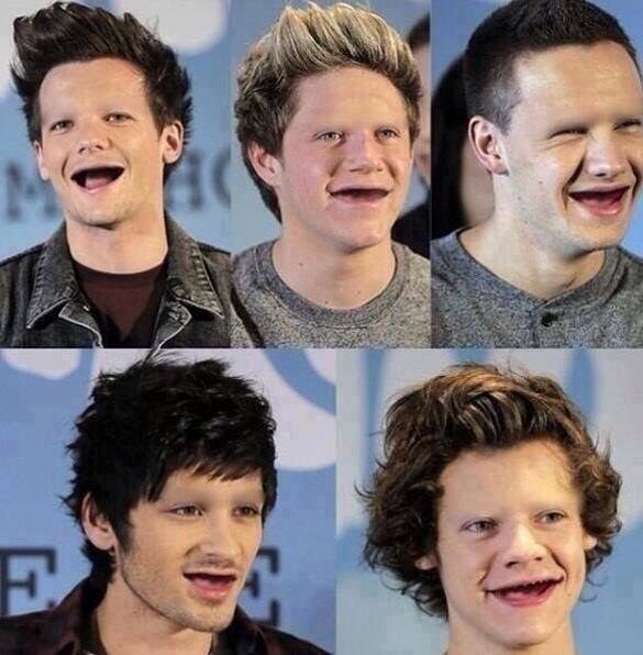 one direction toothless